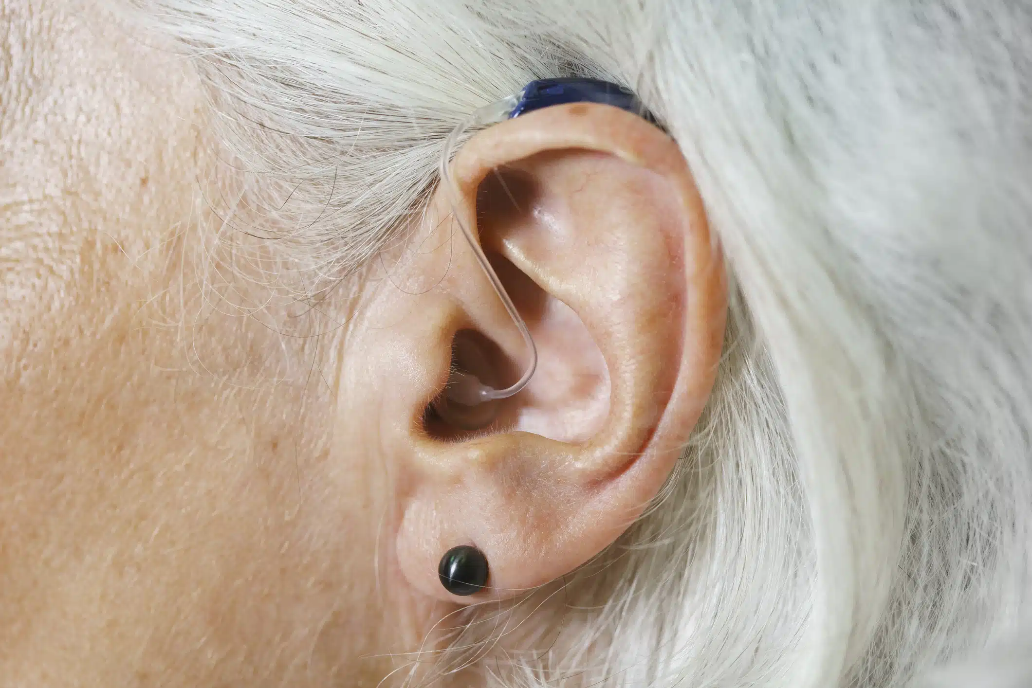 Un appareil auditif pour une personne âgée