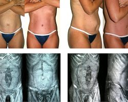 chirurgie esthetique