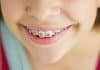 orthodondie