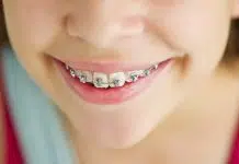 orthodondie