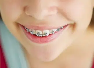 orthodondie