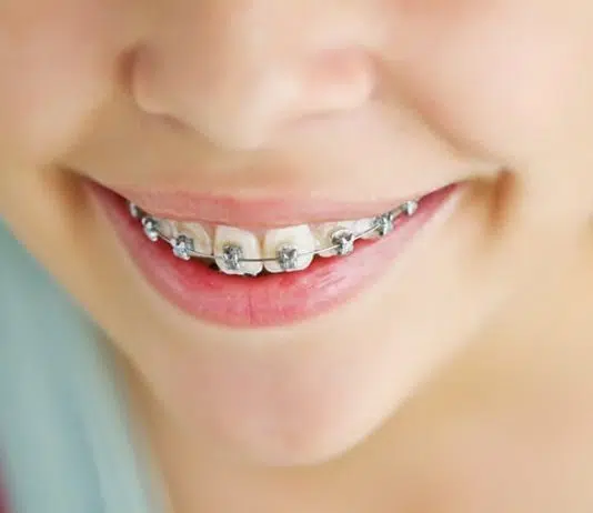 orthodondie