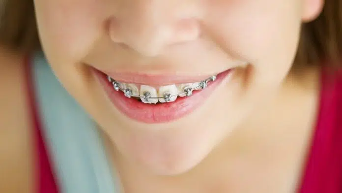 orthodondie